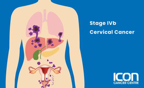 Stage IVb cervical cancer illustration
